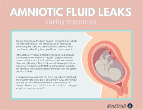 does amniotic fluid leak|Leaking Amniotic Fluid: How to Tell